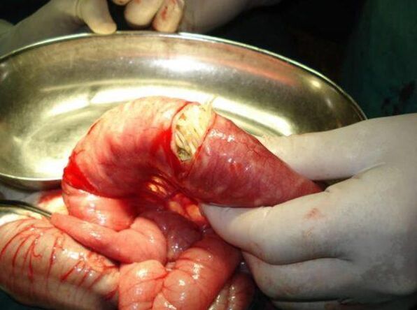 from worms are dangerous