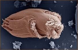 Pathogenic microorganisms in man