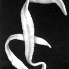 Parasites ribbon in the human body