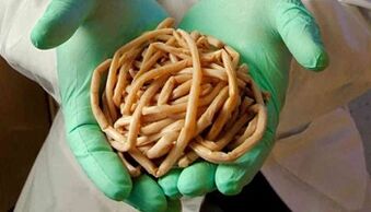 Methods of eliminating pests from the body