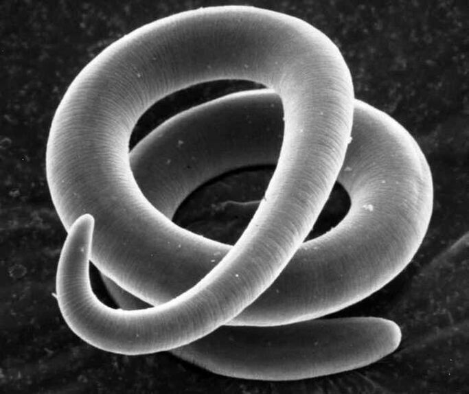 Trichinella under the microscope